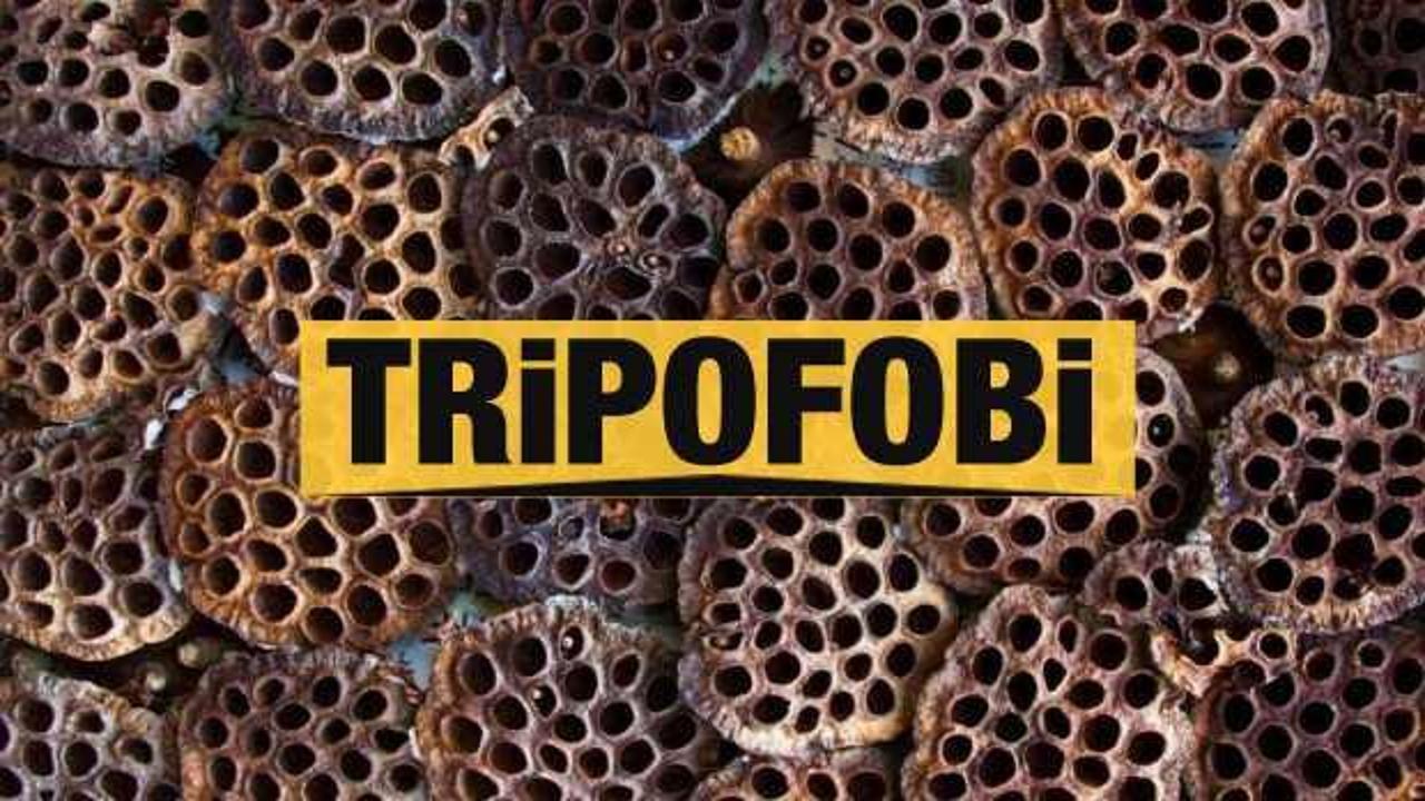 Tripofobi nedir neden olur? Delik fobisi belirtileri ve tedavisi