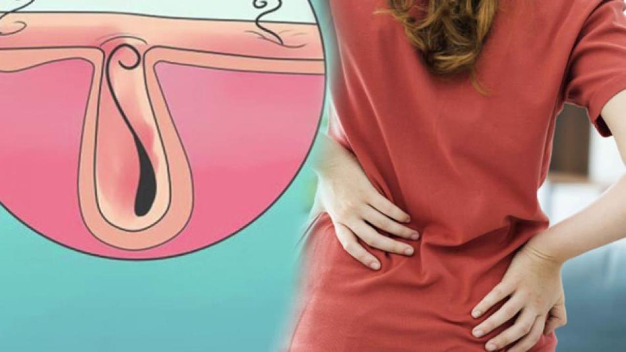 Kıl dönmesi neden olur? Kıl dönmesi belirtileri nelerdir? Kıl dönmesinin doğal tedavisi var mı?