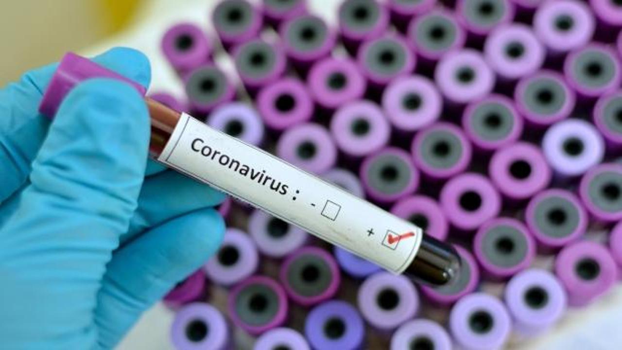 Türk Tabipler Birliği koronavirüs için heyet oluşturdu