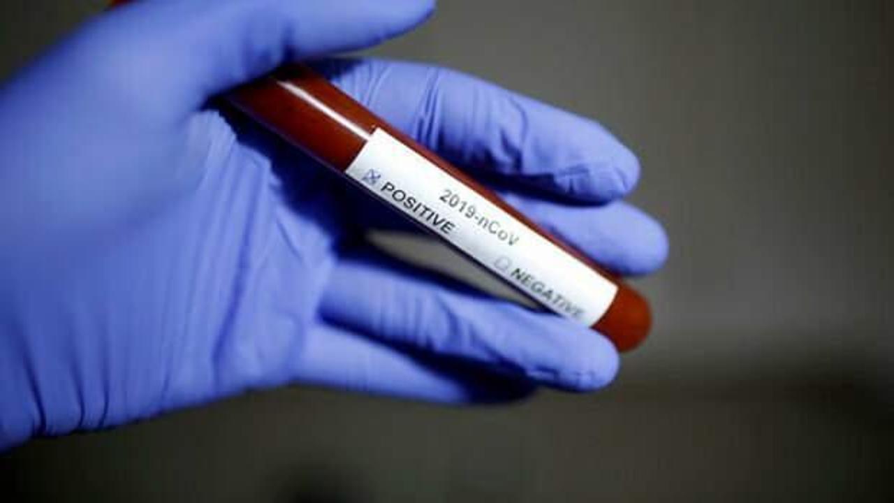Avrupa'da koronavirüs salgını giderek artıyor! Korkunç rakamlar