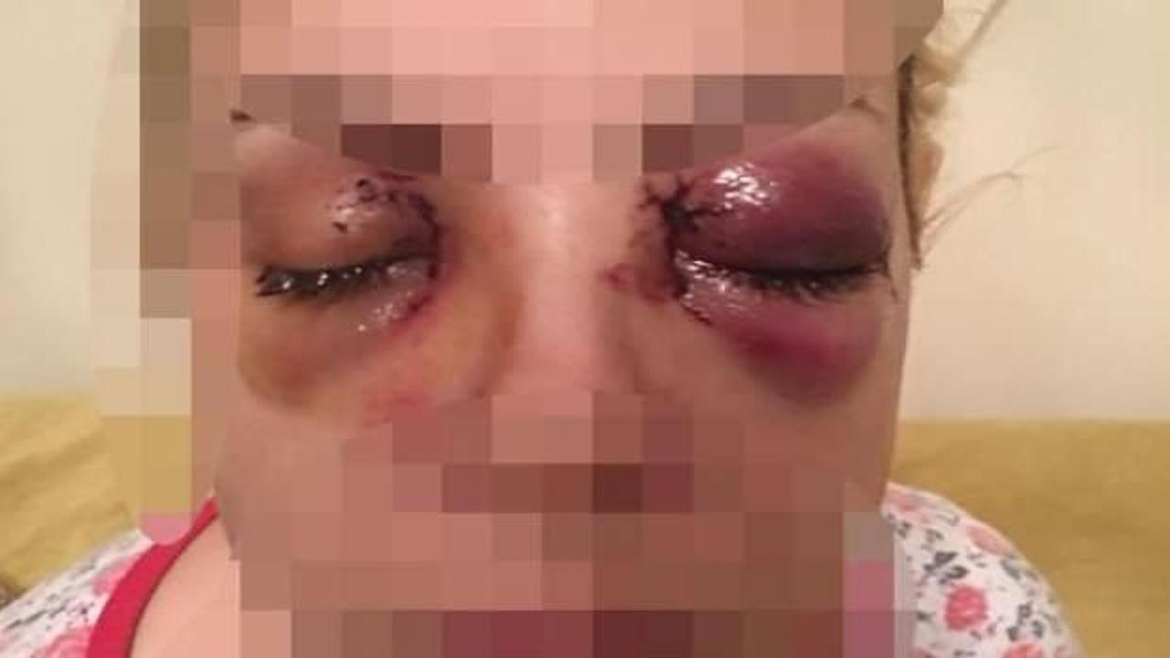 G&ouml;zleri oyulan kadın hastane g&ouml;revlilerini su&ccedil;ladı