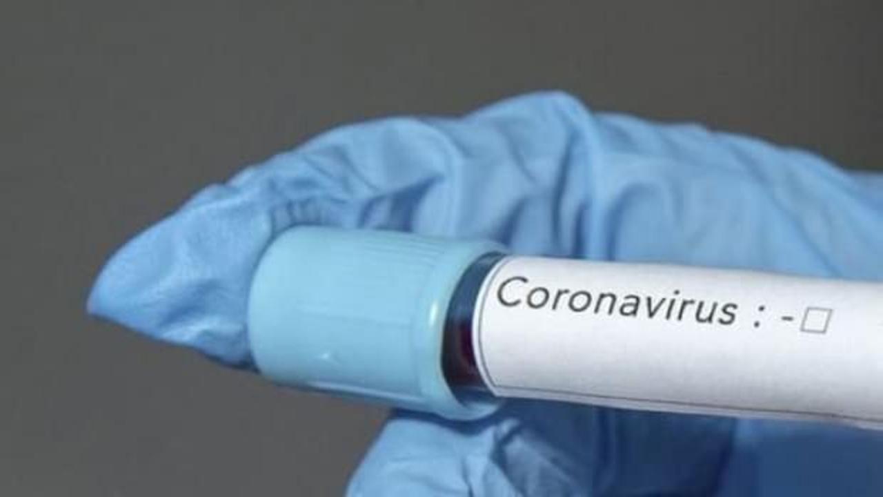 Malezya'dan 'Koronavirüs' açıklaması