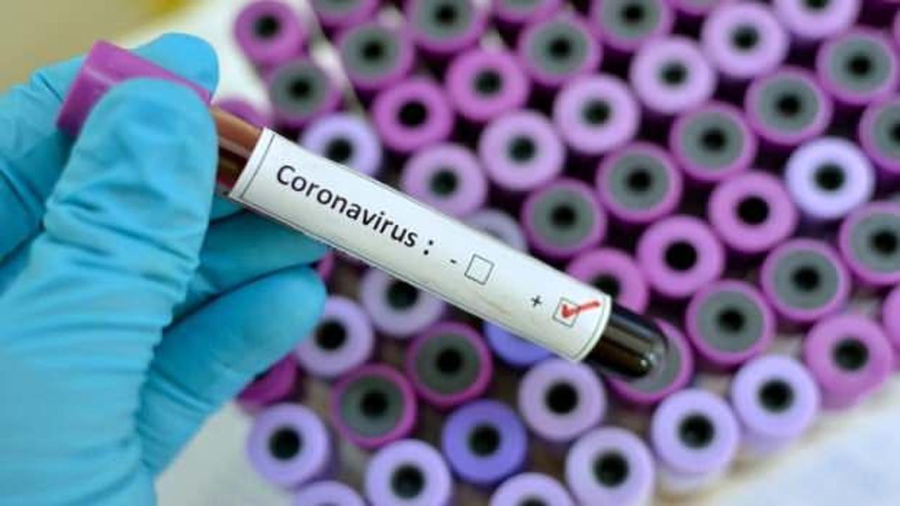 Güney Kıbrıs'ta koronavirüs vakaları arttı