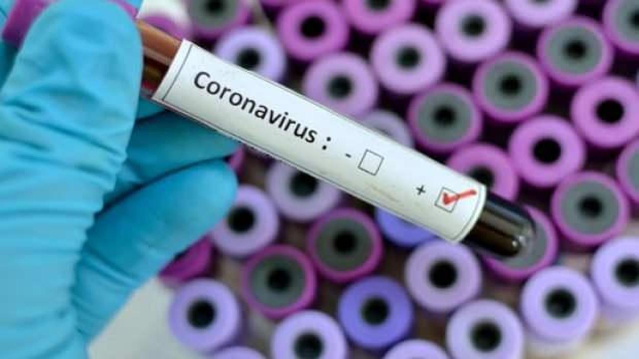 Güney Kıbrıs'ta koronavirüs vakası 33'e çıktı