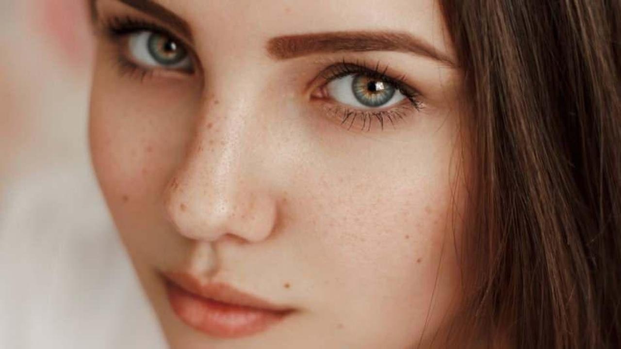 &Ccedil;il nedir? Y&uuml;zde oluşan &ccedil;illeri nasıl ge&ccedil;er? &Ccedil;illeri yok eden en etkili 5 y&ouml;ntem