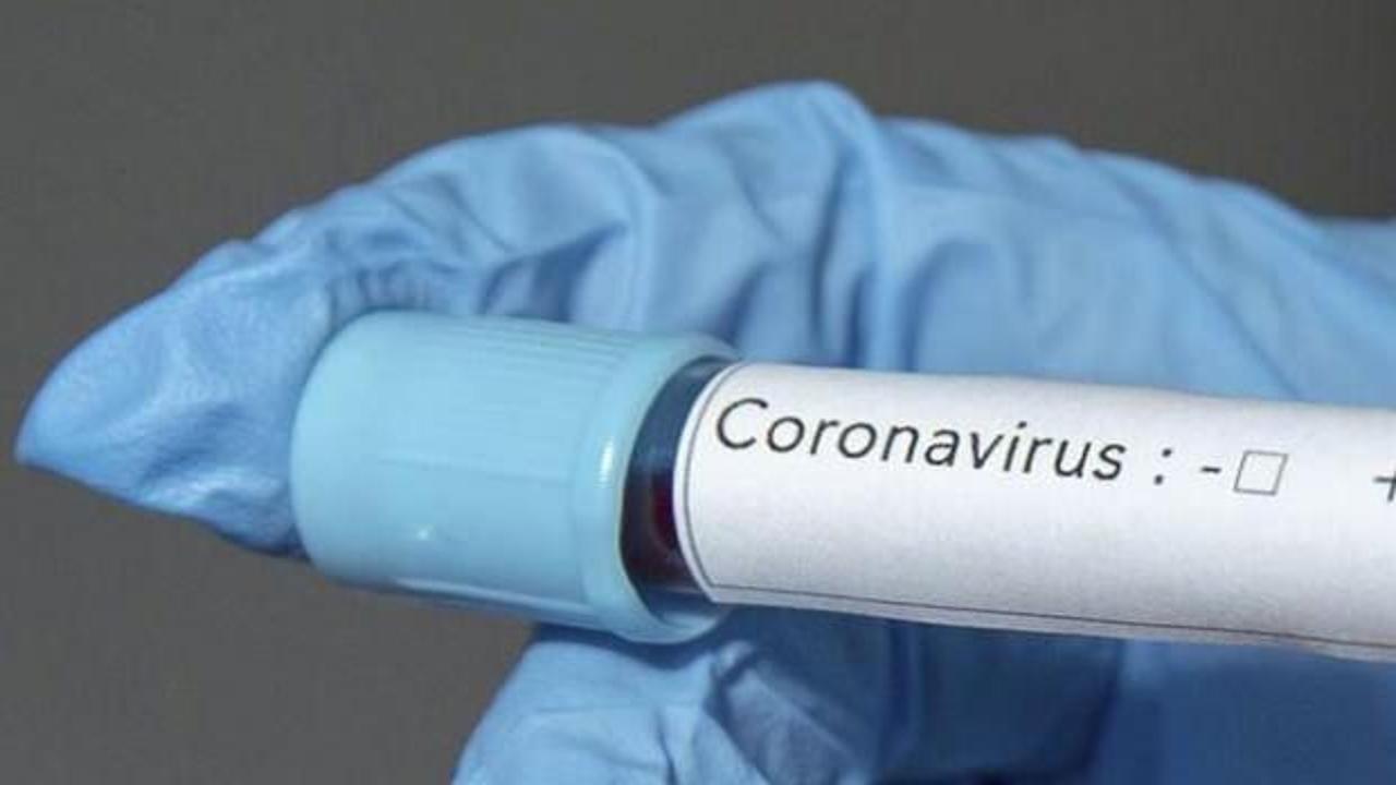 İtalya Başbakanı Conte'den koronavirüs açıklaması: Sinsi düşmanla savaşıyoruz