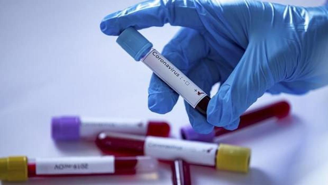 Katar'da koronavirüs vaka sayısı 634'e yükseldi