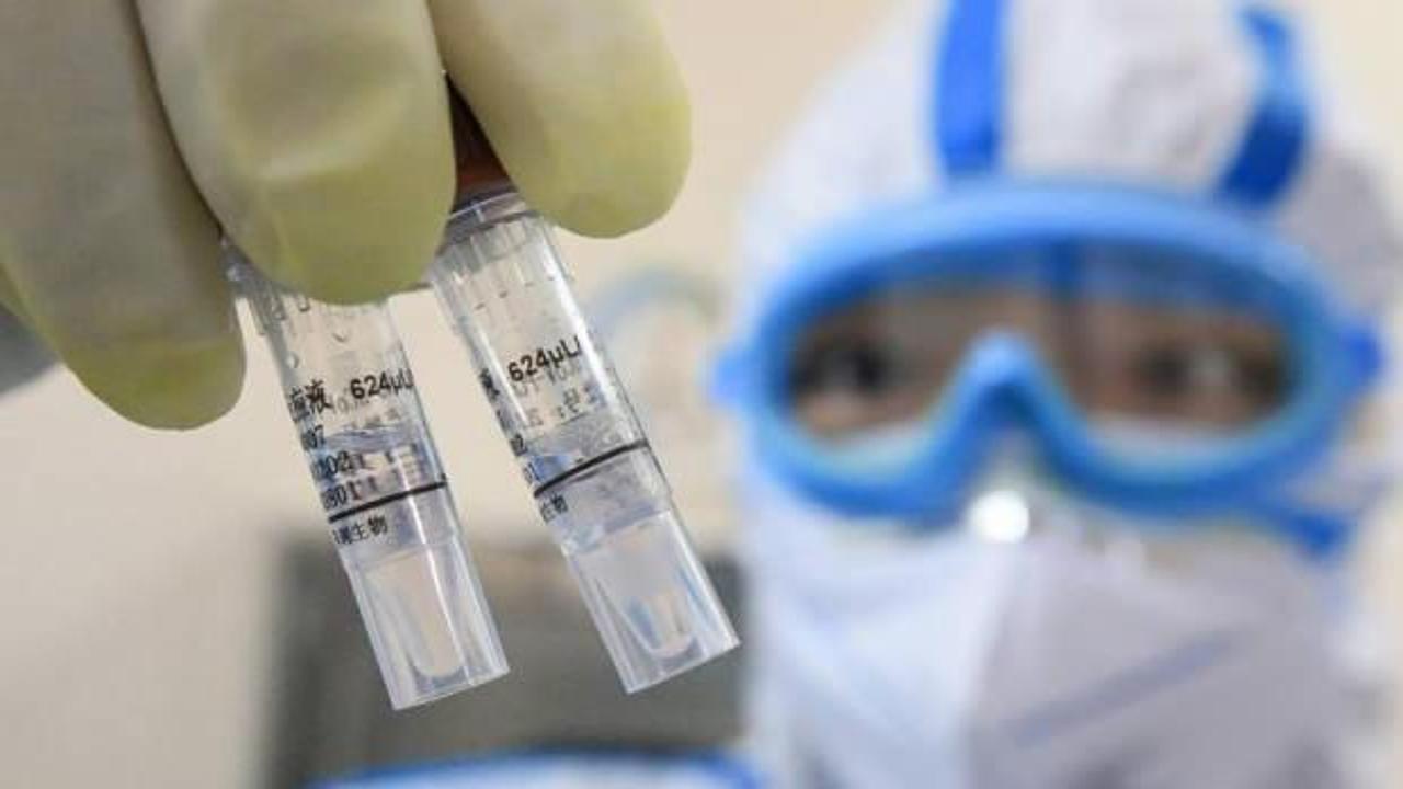 Çinli bilim insanları koronavirüse karşı 'oldukça etkili' antikor tedavisi geliştirdi