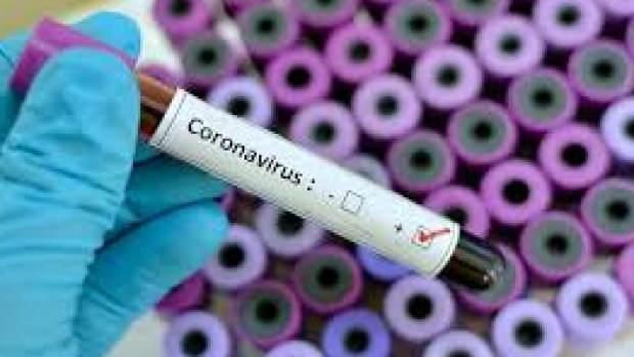 Fransa'da koronavirüs kabusu: Ölü sayısı: 6 bin 500'ü geçti