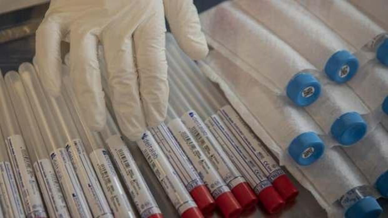 350 İBB çalışanında koronavirüs tespit edildi
