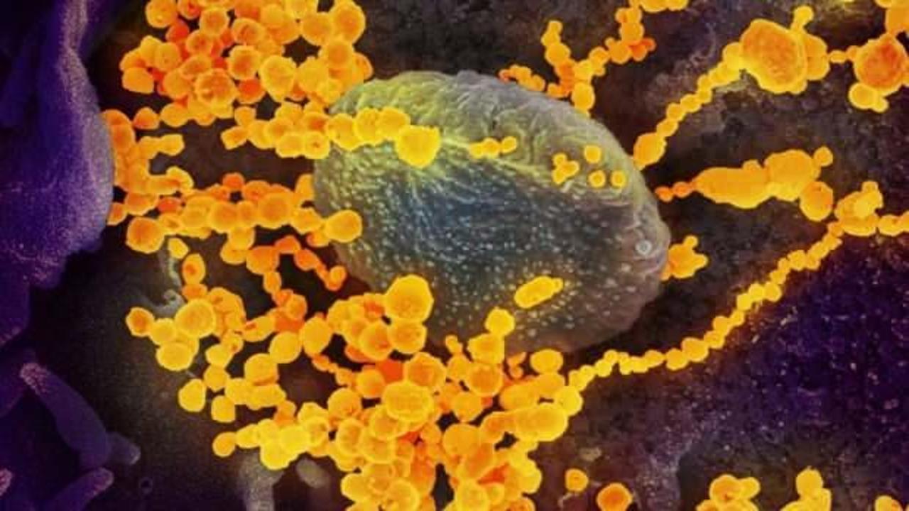Kanser hastası kadın koronavirüsü yendi