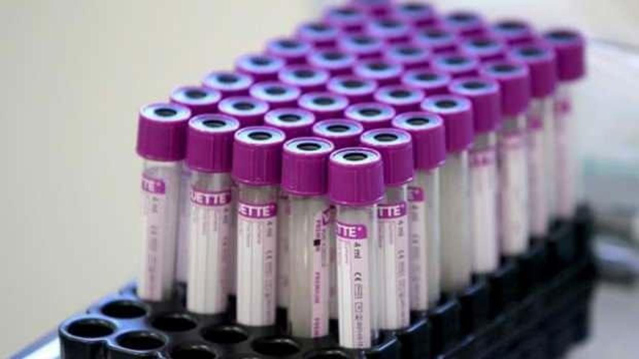 NY Times duyurdu: FDA koronavirüs için ilk ilacı onaylıyor