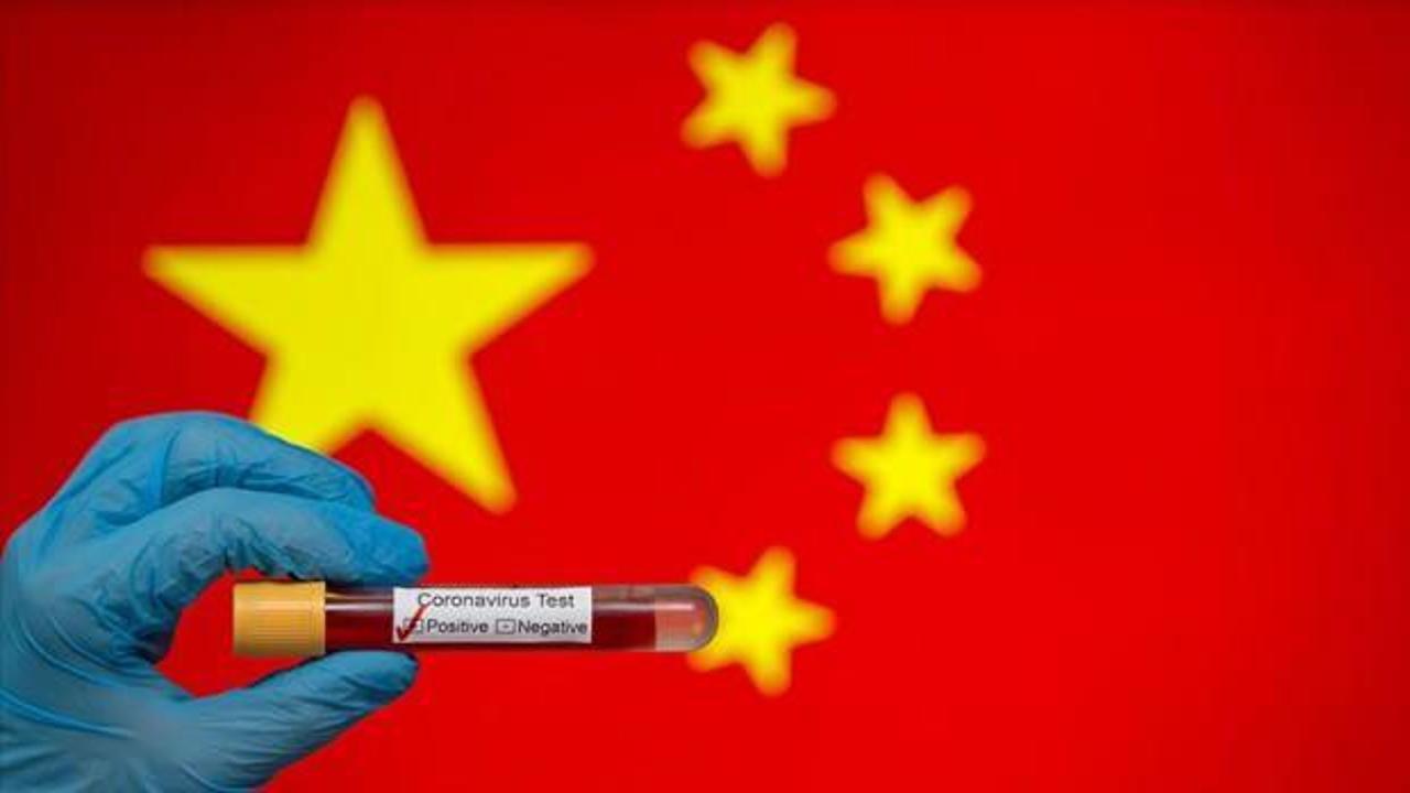 Uzmanlardan Çin'e kötü haber: Koronavirüs faturasını çıkardılar