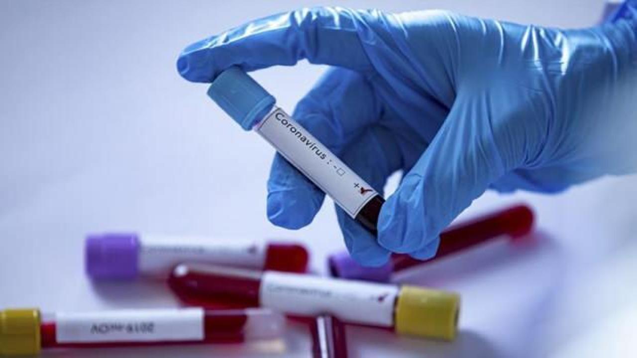 Koronavirüsün seyri bundan sonra nasıl olacak?