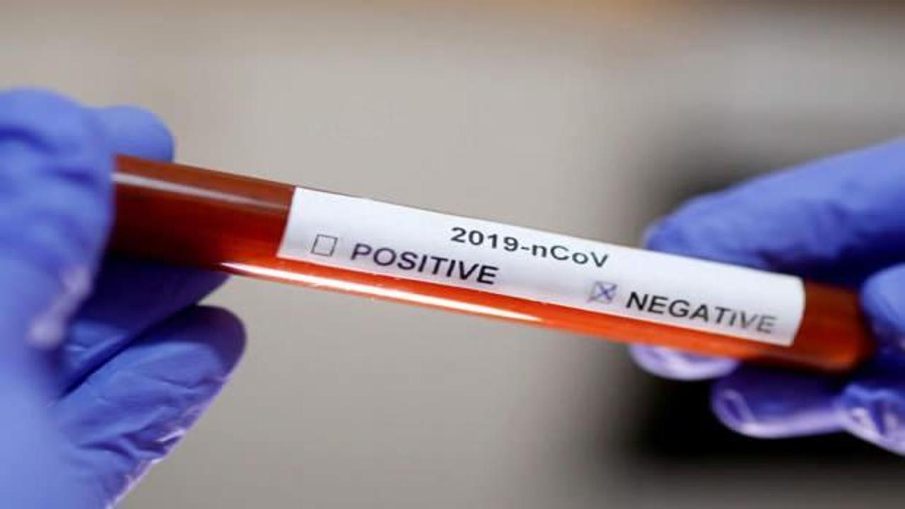 Test negatif &ccedil;ıktı, aynı g&uuml;n hayatını kaybetti