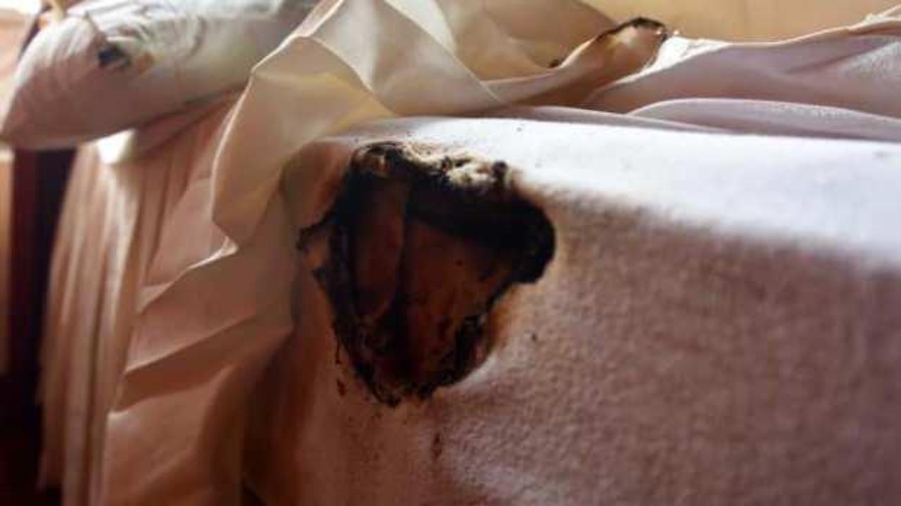 Evde kendiliğinden yangın &ccedil;ıkıyor!