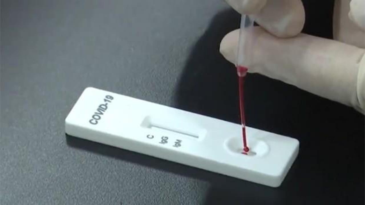 FDA'dan reçetesiz Kovid-19 ev test kitine onay