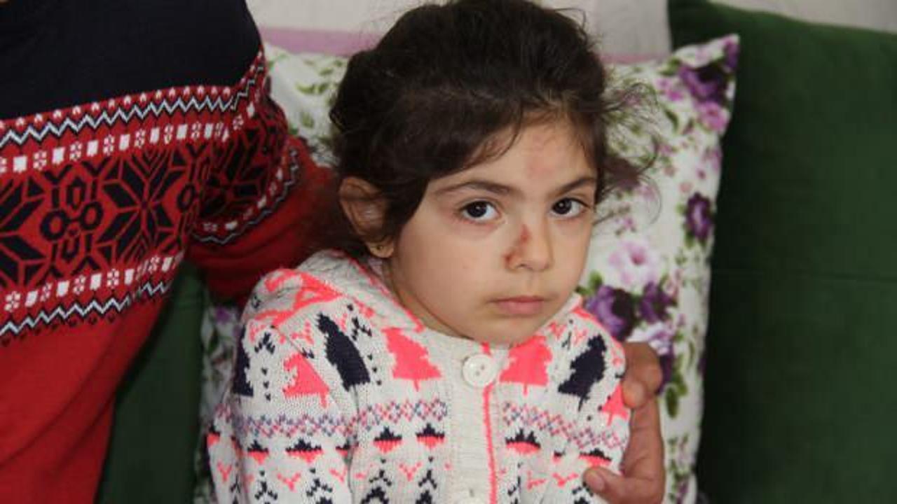 Evinin &ouml;n&uuml;nde araba &ccedil;arpan k&uuml;&ccedil;&uuml;k kız korkudan sokağa &ccedil;ıkamıyor