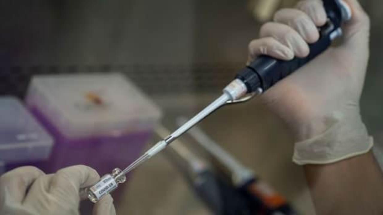 Türk bilim insanı corona virüs aşısı için tarih verdi 