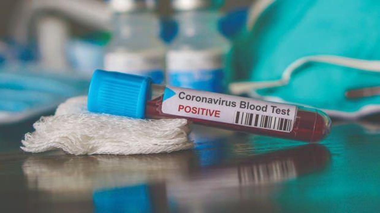 Kan grubu Koronavirüs'ün bulaşıcılığına etki ediyor