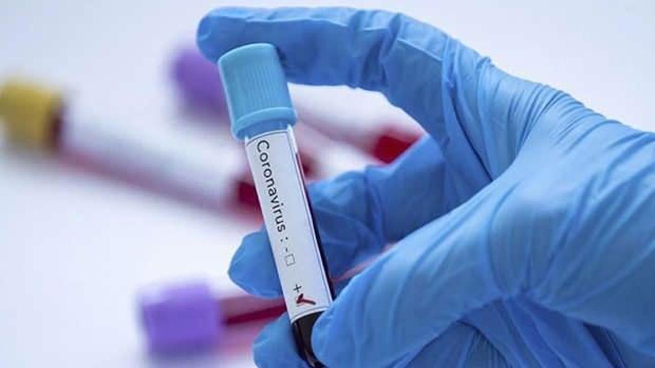 Antikor testi nasıl yaptırılır? Koronavirüse karşı bağışıklık oranınızı gösteren test nasıl ...