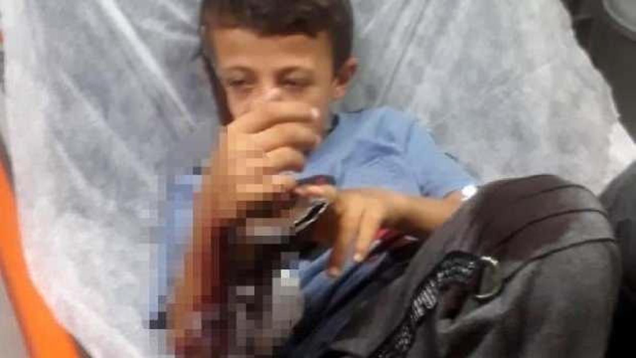 Eline saplanan korkuluk demiriyle hastaneye g&ouml;t&uuml;r&uuml;ld&uuml;