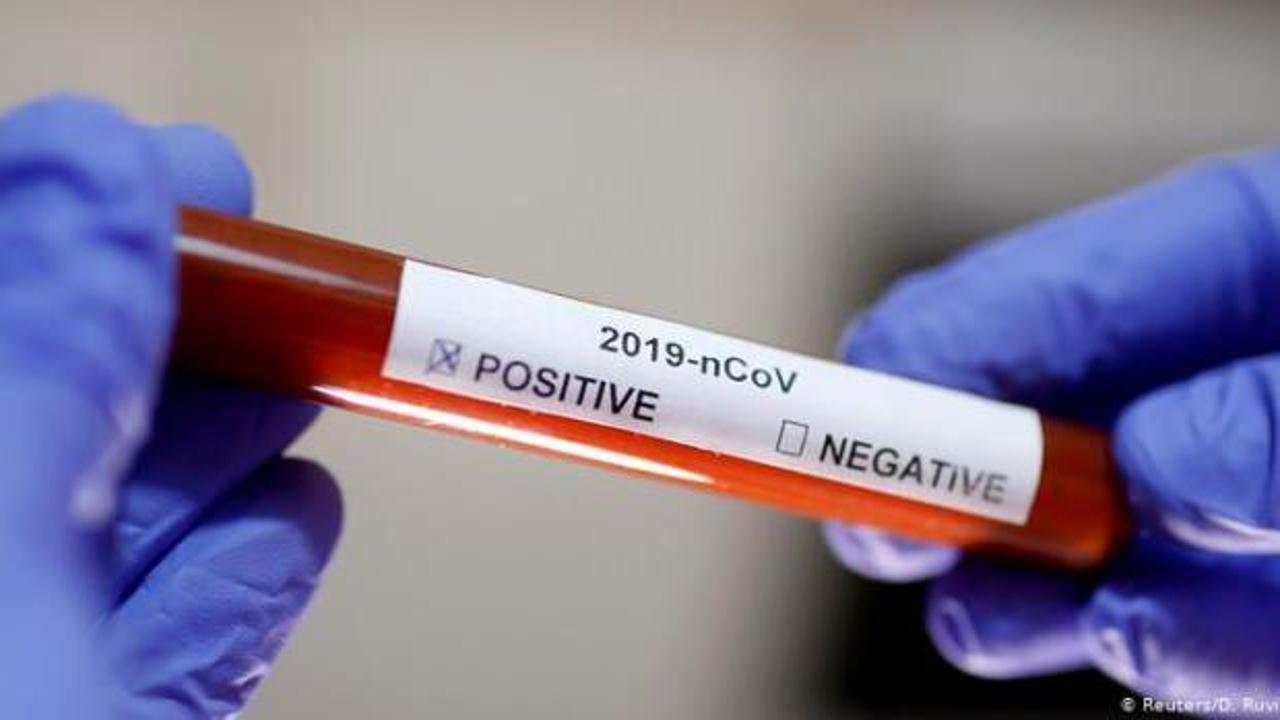 Orta Amerika'da koronavirüs ölümleri artıyor