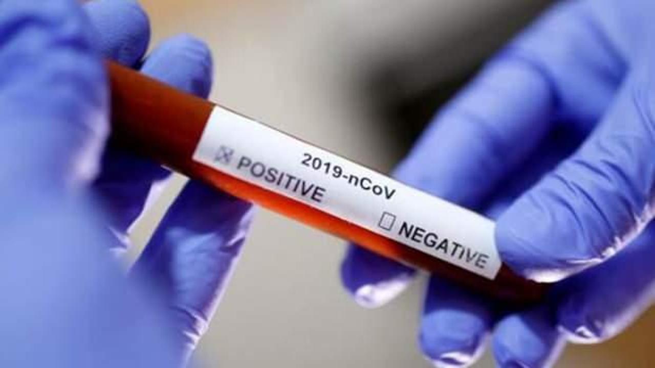Öğrenci yurdunda 133 kişide koronavirüs tespit edildi