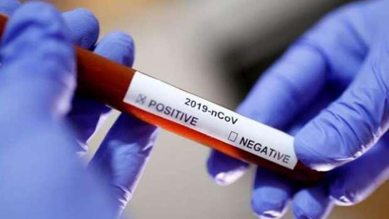 Aile hekimi, hemşire ve sekreter koronavir&uuml;s oldu