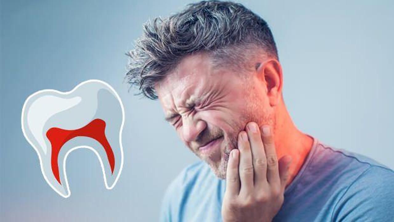 Diş ağrısı nasıl geçer? Gece şiddetli diş ağrısını ilaçsız geçirme yolları  - Haber 7 SAĞLIK