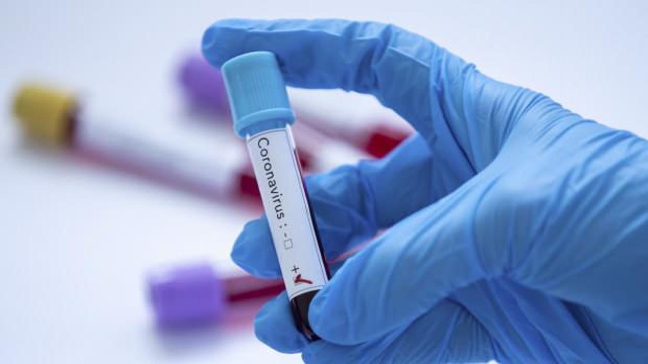 Koronavirüse yakalanan Asiye Kara acil plazma bekliyor