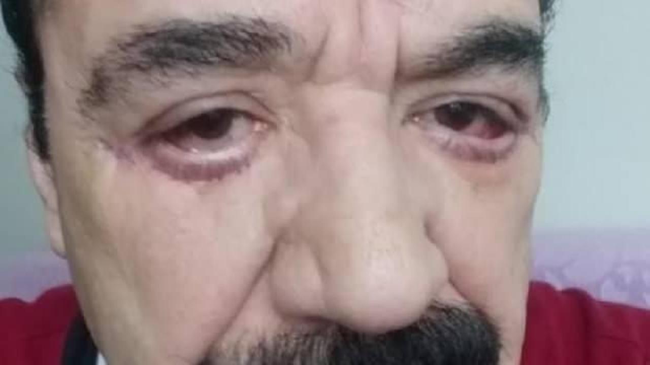 Göz doktoruna hatalı estetik iddiası!