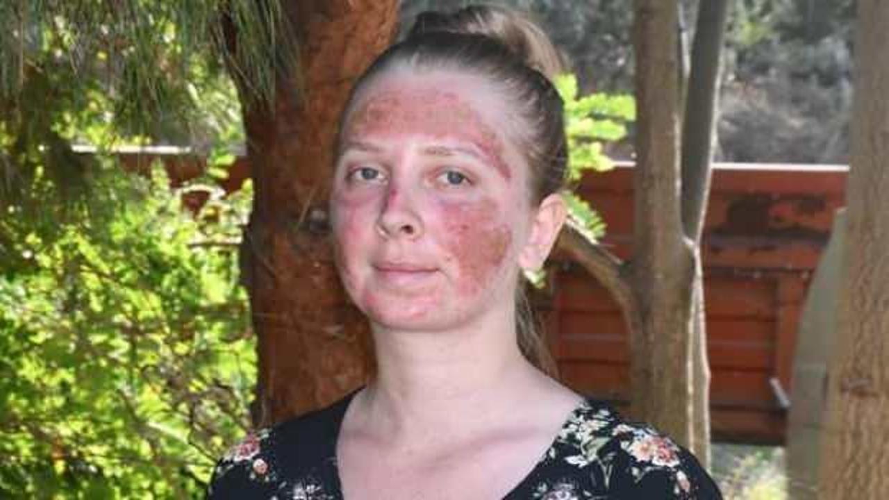 29 yaşındaki kız hayatının şokunu yaşadı!