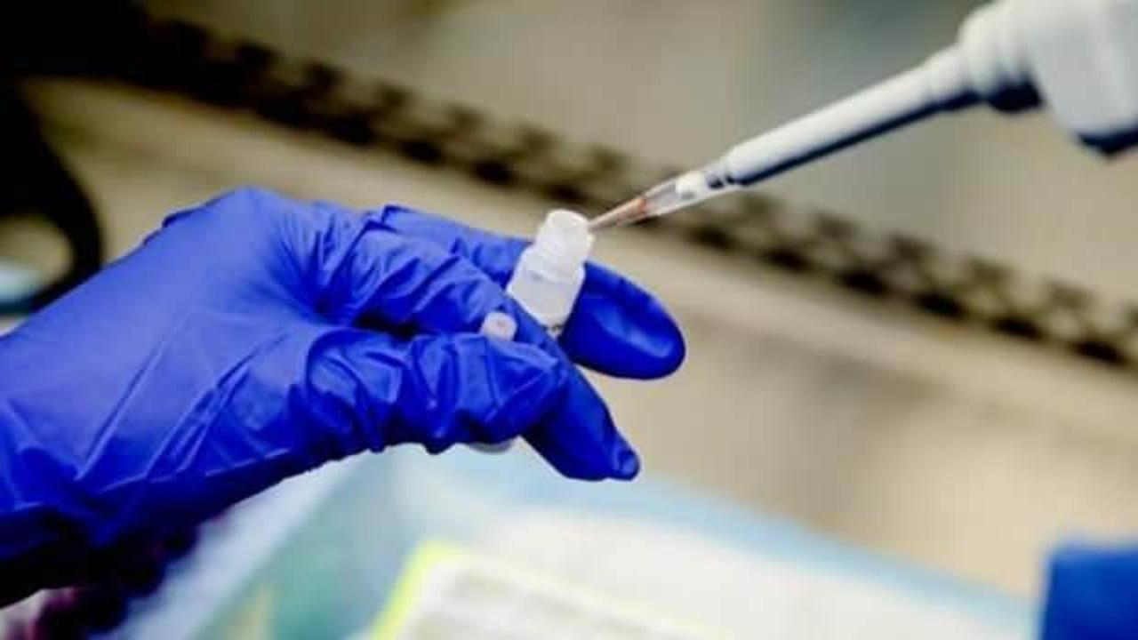 Aşı Bilimi Derneği Başkanı Gürüz: "Kovid-19 aşısının martta hazır olacağına inanıyorum"