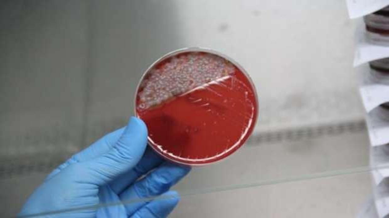 Uzun süre kullanılan maskedeki bakteriler laboratuvarda gözler önüne serildi