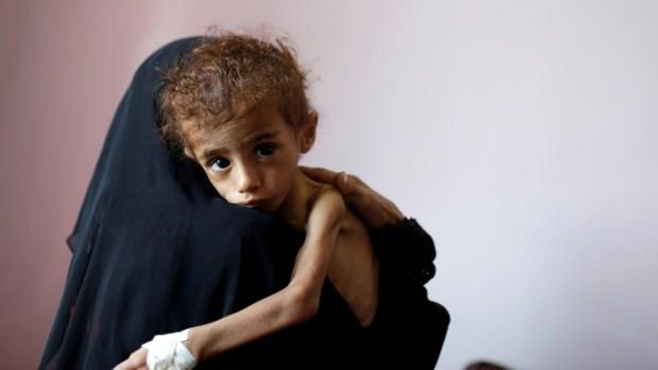 BM: Yemen, kıtlık tehlikesi ile karşı karşıya