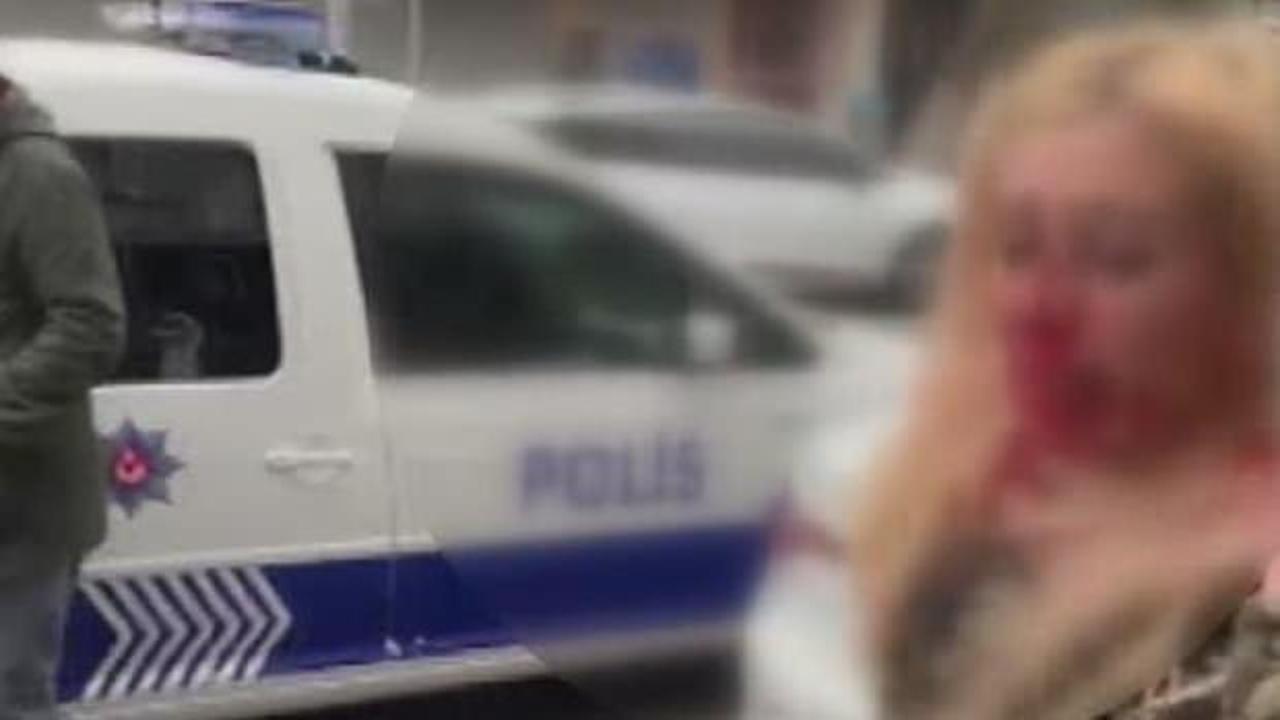 Kadına kafa atarak kanlar i&ccedil;inde bıraktı!