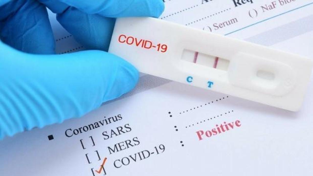 Koronavirüs testinde kritik tarih 22 Kasım: Ücret iadesi isteyin!