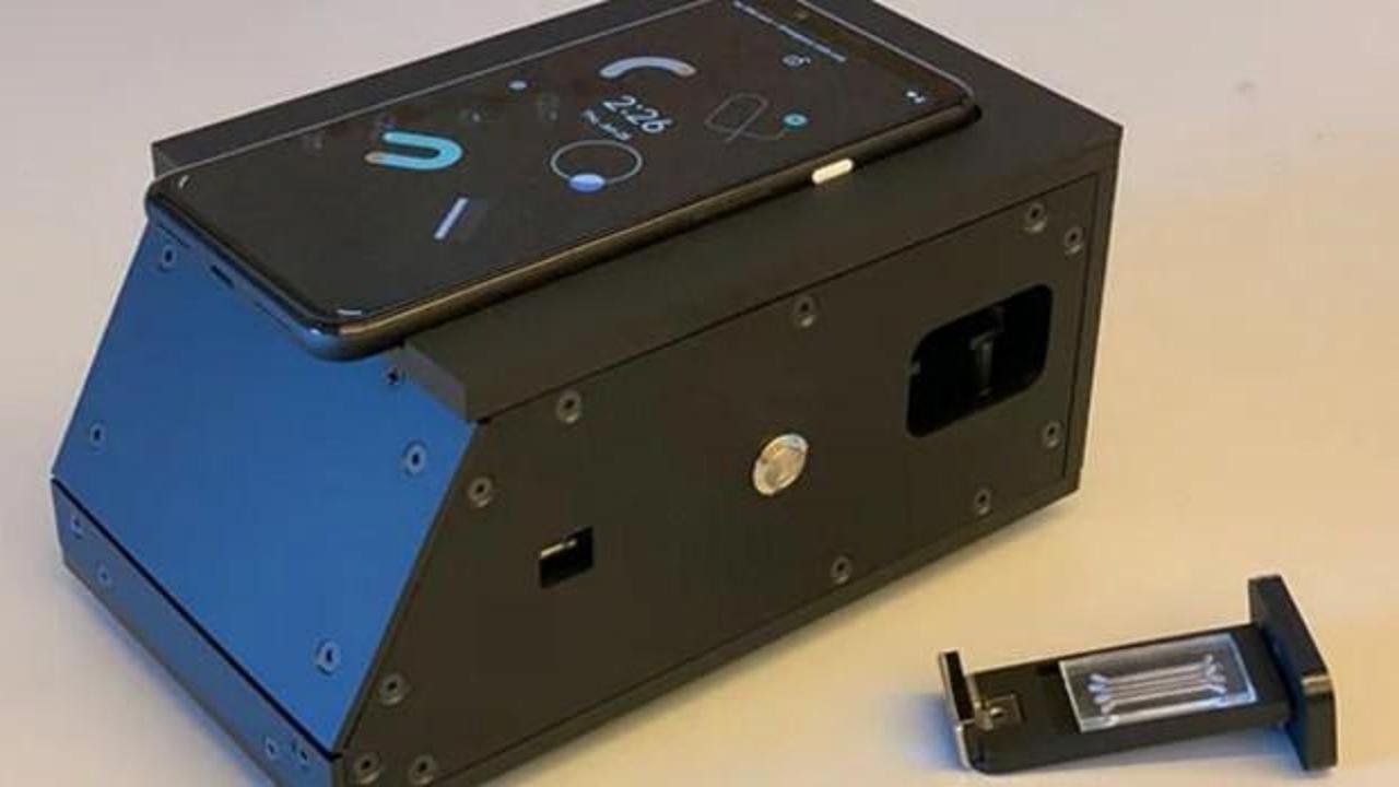 Akıllı telefon kamerasıyla koronavir&uuml;s&uuml; teşhis eden test geliştirildi