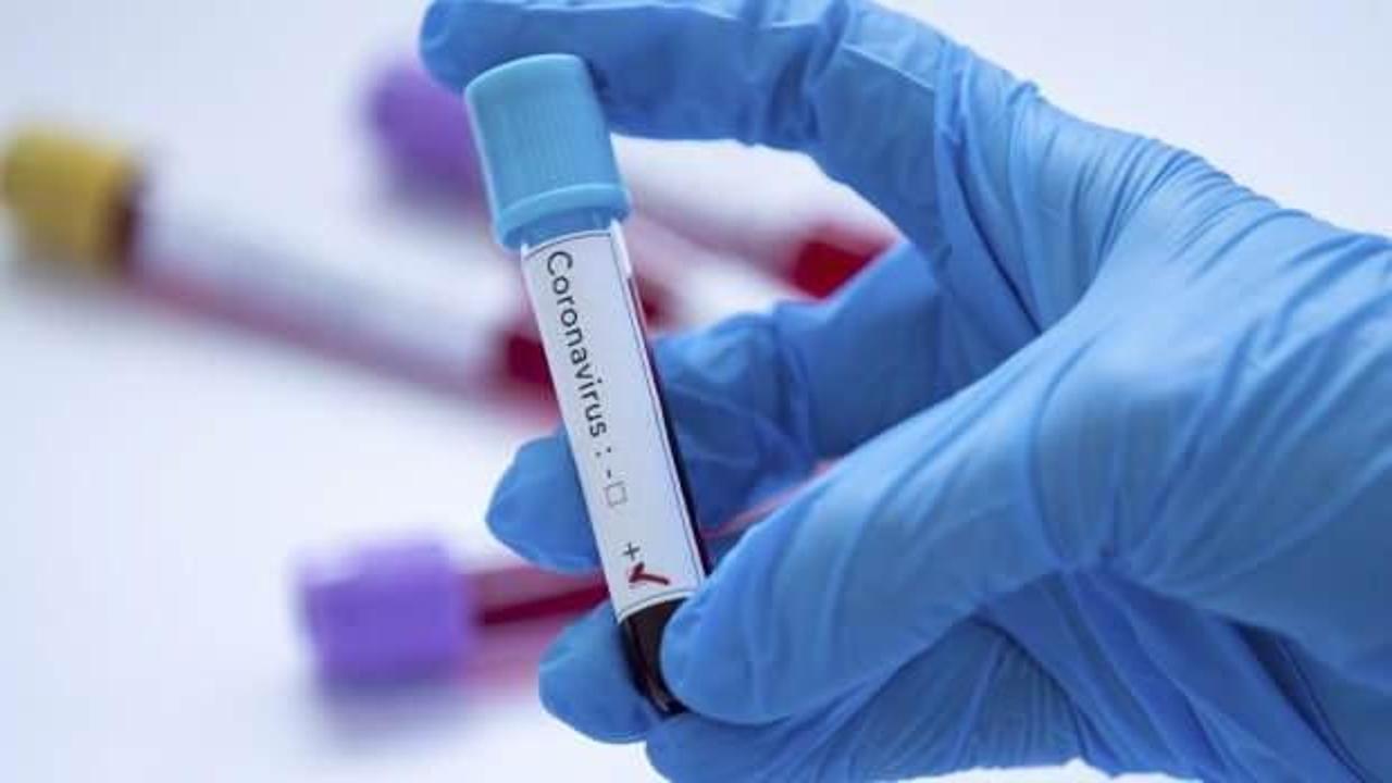 Malavi'de 2 bakan koronavirüs nedeniyle yaşamını yitirdi