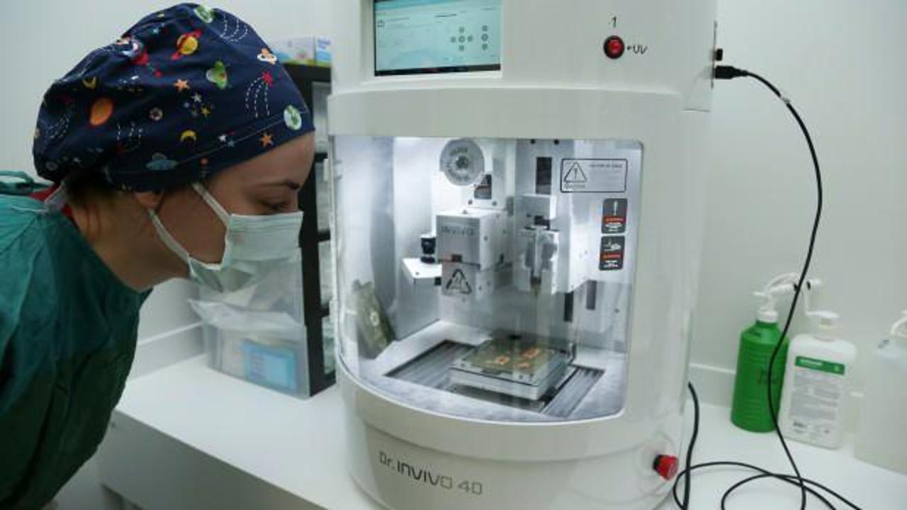 Dünyada bir ilk! Yanık tedavisinde 4D teknolojisi sadece Türkiye'de uygulanıyor