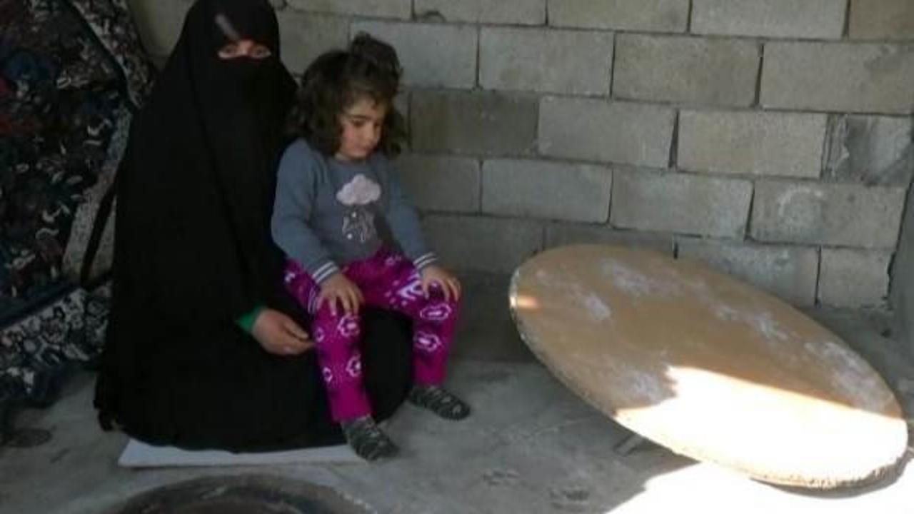 Belden aşağısı tandırda yanan Fatmanur, ayakkabı giyip, koşmak istiyor