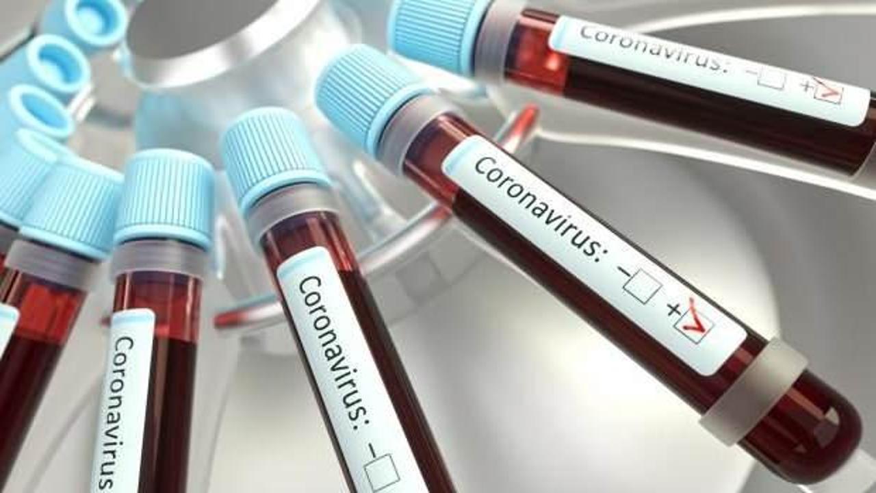 Filistin Ekonomi Bakanı ile Hükümet Sözcüsü koronavirüse yakalandı