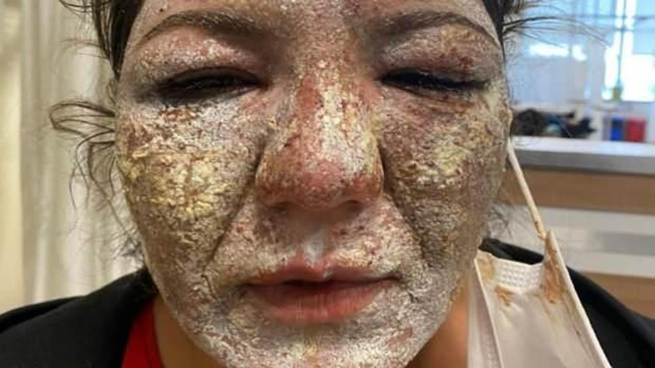 G&uuml;zellik merkezine gitti, hayatının şokunu yaşadı!