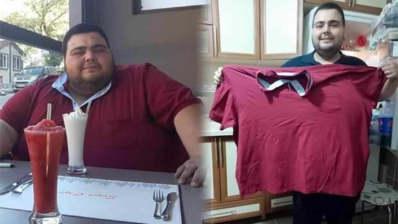 Ankara'da 34 yaşındaki esnaf mide küçültme ameliyatıyla 129 kilo verdi!