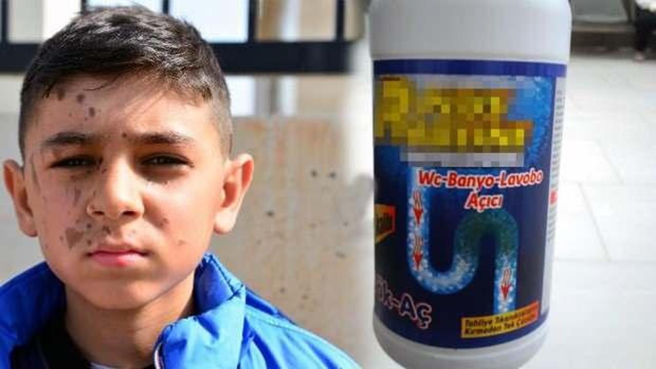 11 yaşındaki Yiğit'in yüzünü arkadaşı temizlik malzemesiyle yaktı!