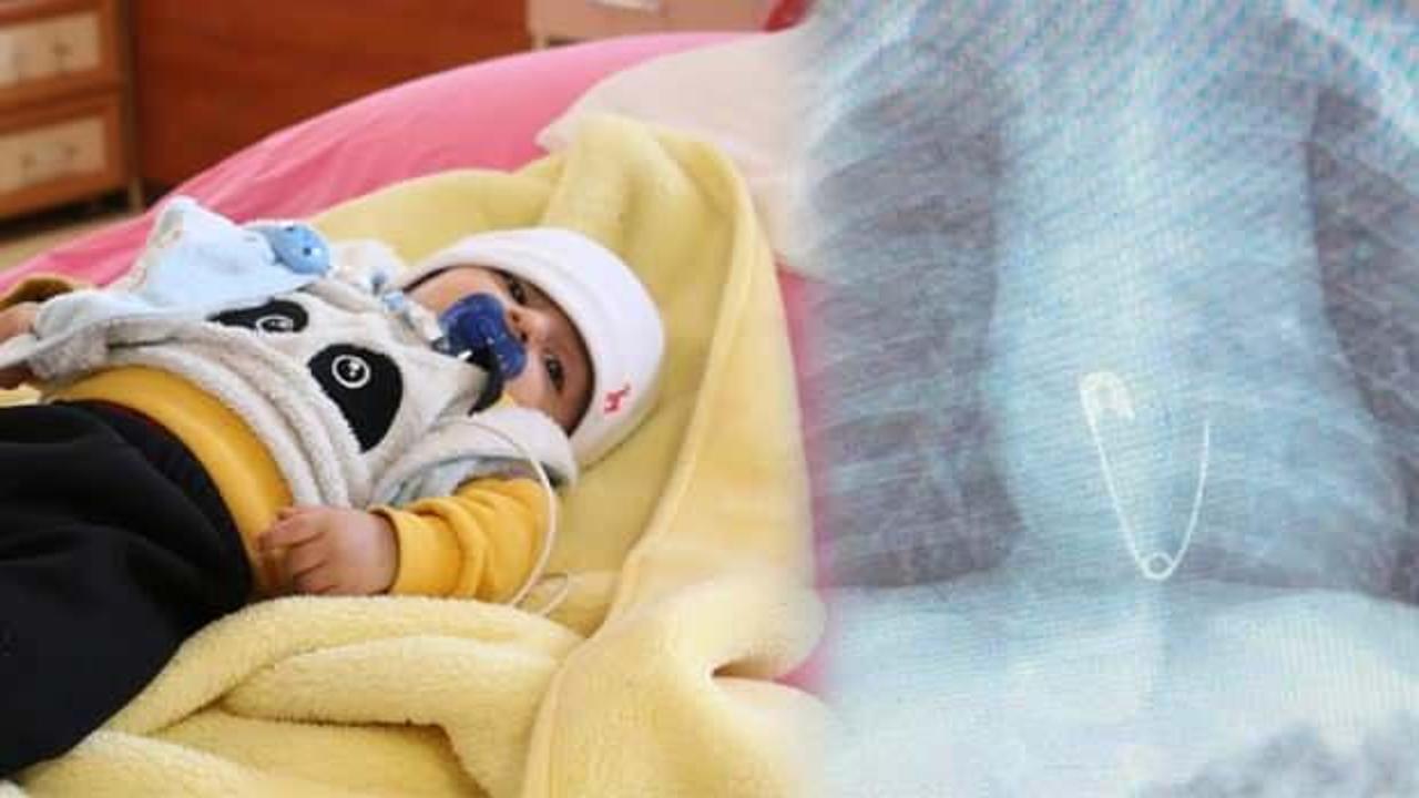 Diyarbakır'da 5 aylık bebek çengelli iğne yuttu, ölümden döndü!