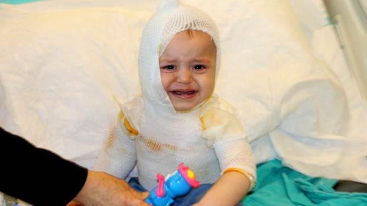 Erzincan'da 1 yaşındaki çocuğun üzerine kaynar süt döküldü! Çocuk feci şekilde yandı