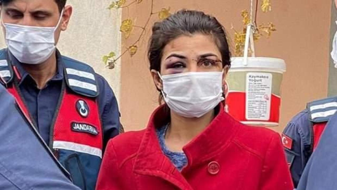 Melek İpek: Kocamı vurdum, &ccedil;abuk yetişin