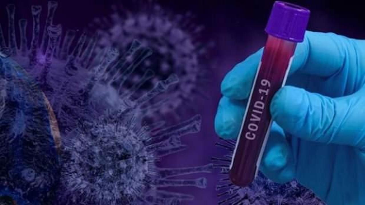Koronavirüs mutasyonuna dikkat! Tunceli’de İngiltere varyantı virüsten ilk ölüm